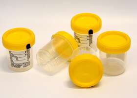 22150107 Fischer Parter 90ml X 53mm Sterile Specimen Container With Yellow Screw Cap 400pc