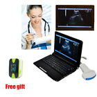 Rus-9000f Carejoy Laptop Machine Full Digital Ultrasound Scanner Convex 190891407115