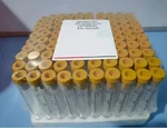 Branded Acd Solution 8.5 Ml Ppt Prf Set Of 200 Tubes +++. Fixed Price $328.84.
