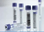 Greiner Bio-one Vacuette Venous Blood Collection Tube, Ml, 13 X 75 Mm (1200/CS. Fixed Price $198.80.